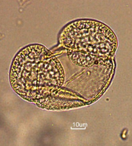 Photo 11: Grain de pollen de pin, muni de ses deux sacs aériens typique des conifères.